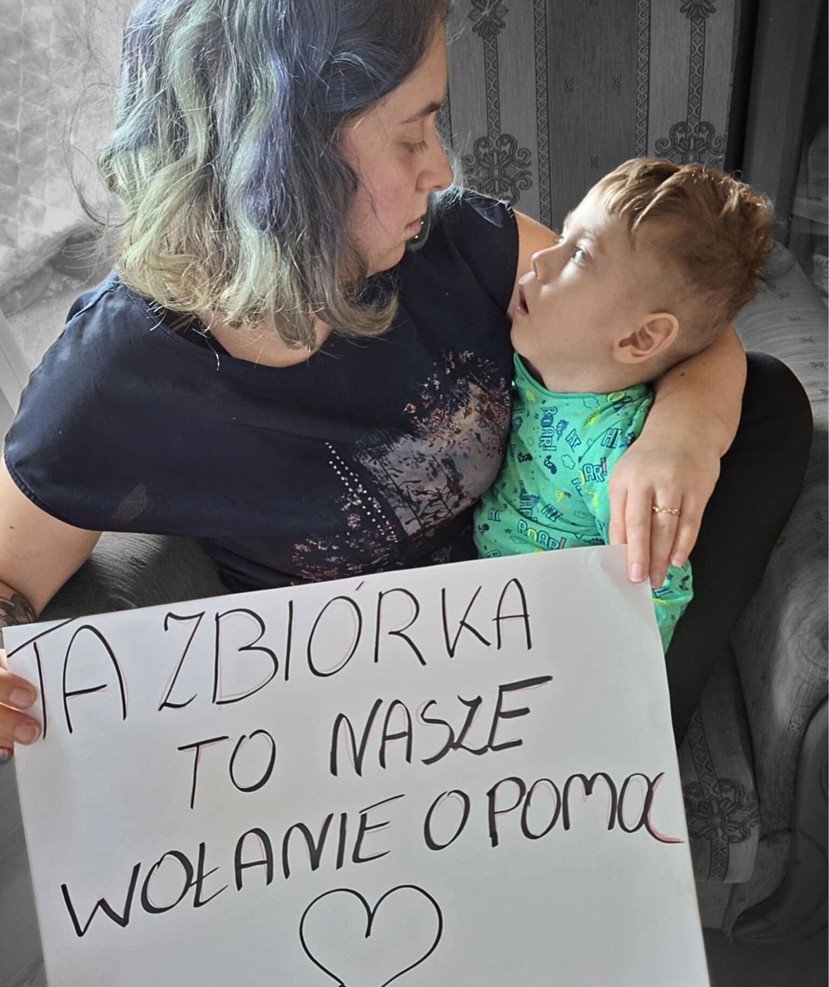 Bruno z AVSD Bruno Chruściński z wrodzoną wadą serca w postaci ubytku przegrody mi Wrodzona wada serca - ubytek przegrody przedsionkowo - komorowej - AVSD