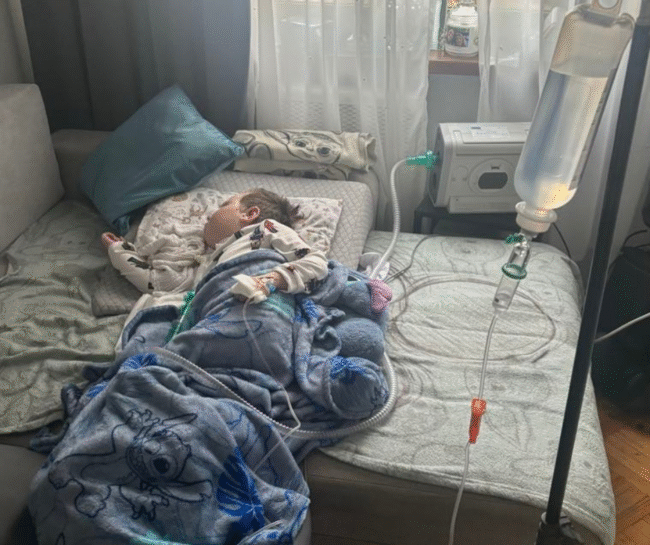 Aleksy po resuscytacji – zespół Leigha